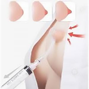 Nipple puller cup vakum sedot alat penarik puting tenggelam untuk ibu menyusui atau wanita muda